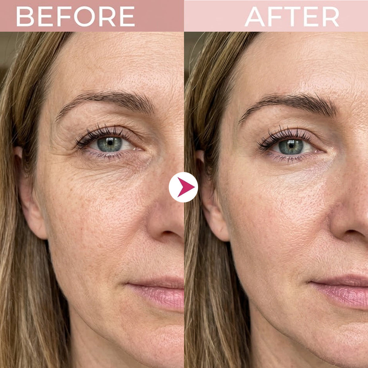 Before and after appearance of eye area